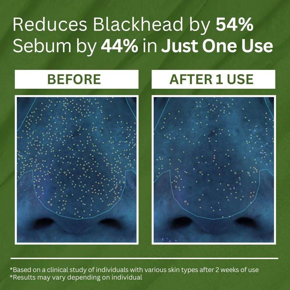 P.CALM Holy Basil Carbonated Mask: Transforming Clay-to-Bubbles Deep Pore Cleanser, Blackhead & Sebum Control, 90g Spa Experience Makeup Organizers