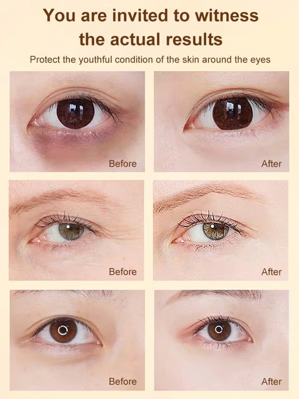 Dinkiss Lutein Eye Essence Oil