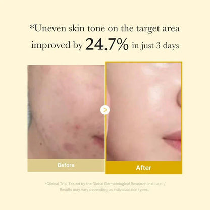 [MedicubeOfficial]Kojic Acid Turmeric Night Wrapping Mask|Overnight Wrapping Mask,Morning Shed,Turmeric,Niacinamide,Vitamin C