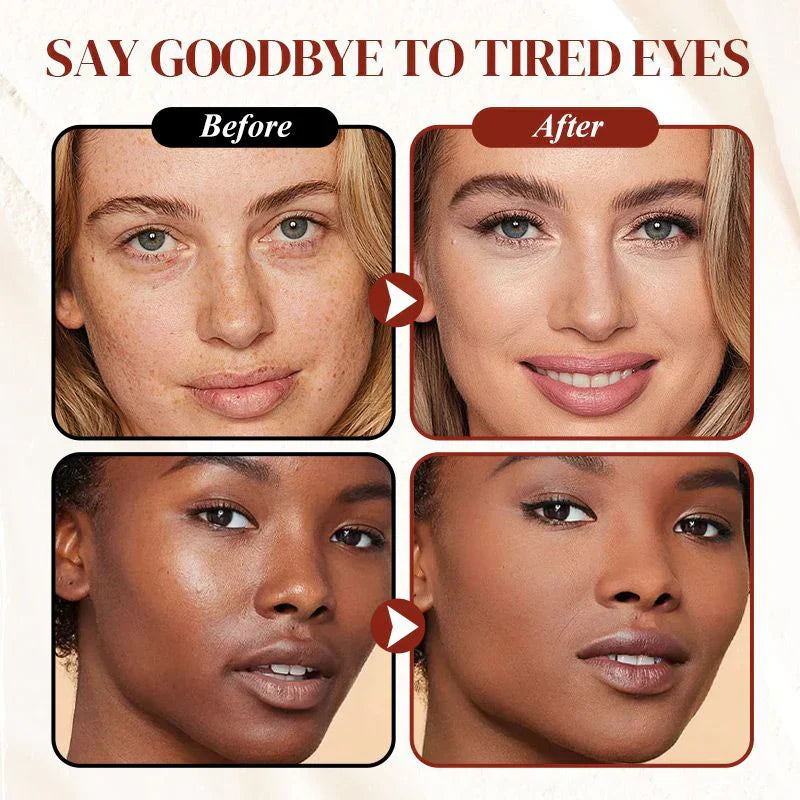 🎁💥 LAST DAY PROMOTION - BUY 1 GET 1 FREE 💥🌟 Undereye Corrector