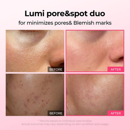 [Dr.Melaxin Official Shop]Lumi Pore & Spot Care Duo | Shrinks Pores & Fades Blemish Marks | Cyano Pink Spicule Serum + Picotonic Shot Ampoule