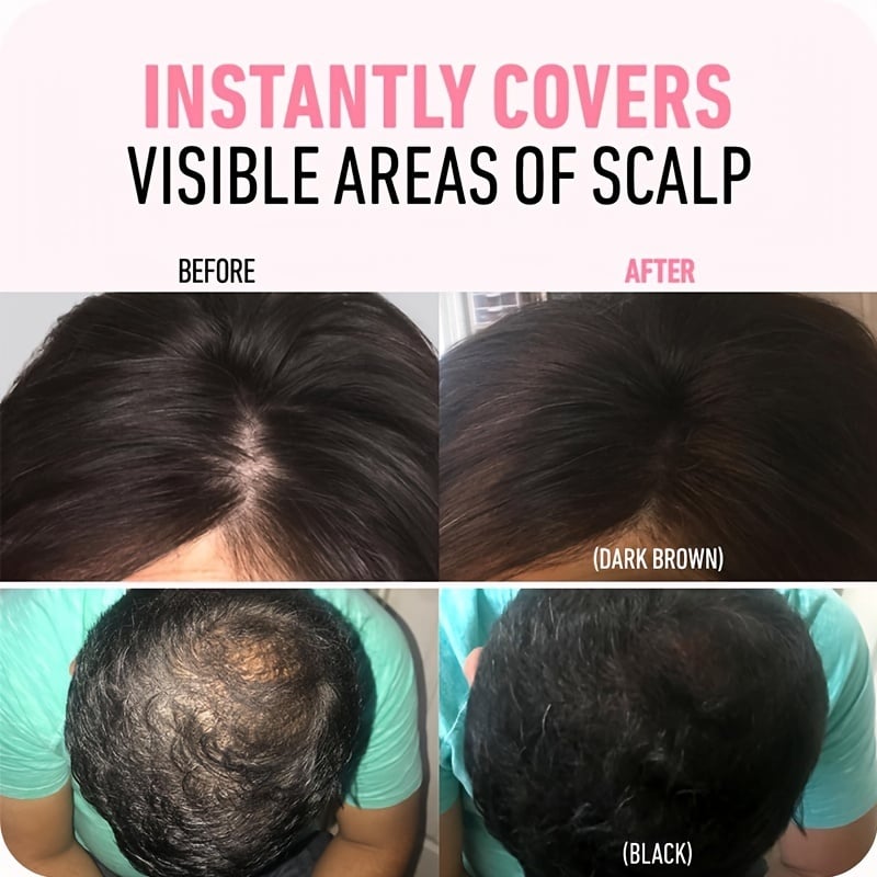 💗Hairline Powder - Magic Root Cover Up (fit all hair color)