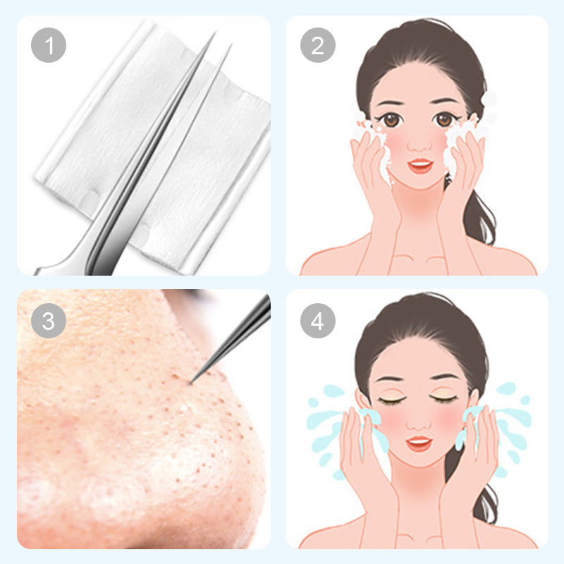 ⏳Limited time 50% discount💥Stainless Steel Blackhead Remover Tool Kit